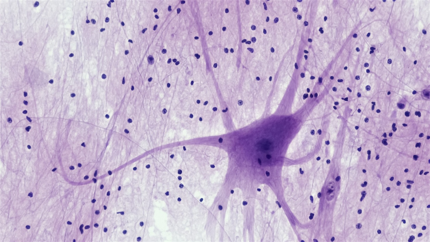 Como a neuropsicanálise pode ajudar adultos com autismo